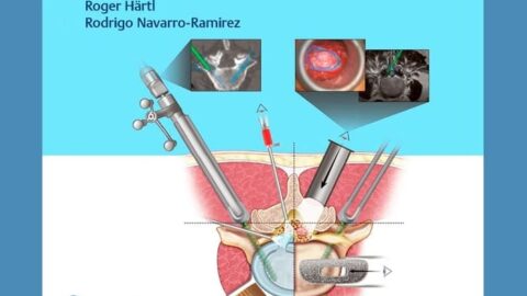 El Dr. Rodrigo Navarro-Ramírez presenta su libro “Essential step-by-step minimally invasive spinal surgery”